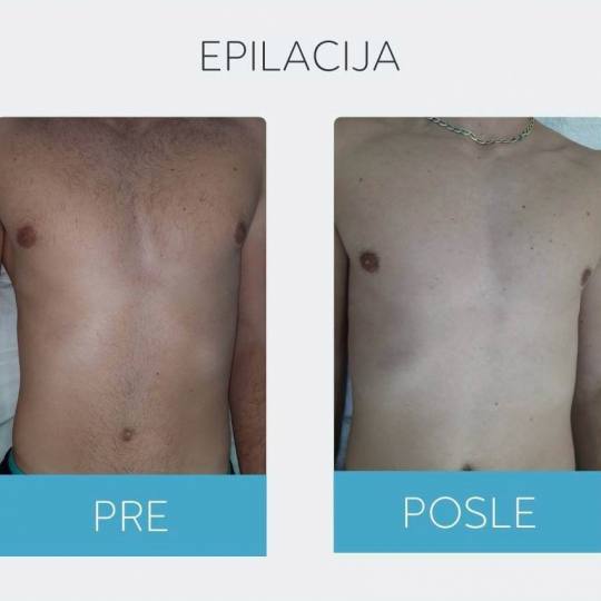 DepilConcept #beograd