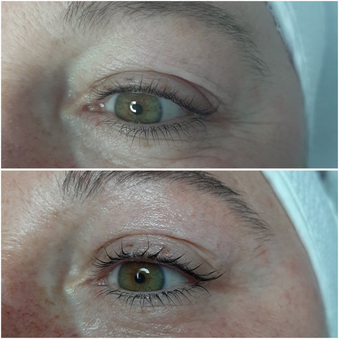 Look at me #beograd Tretman lica Eyelid booster