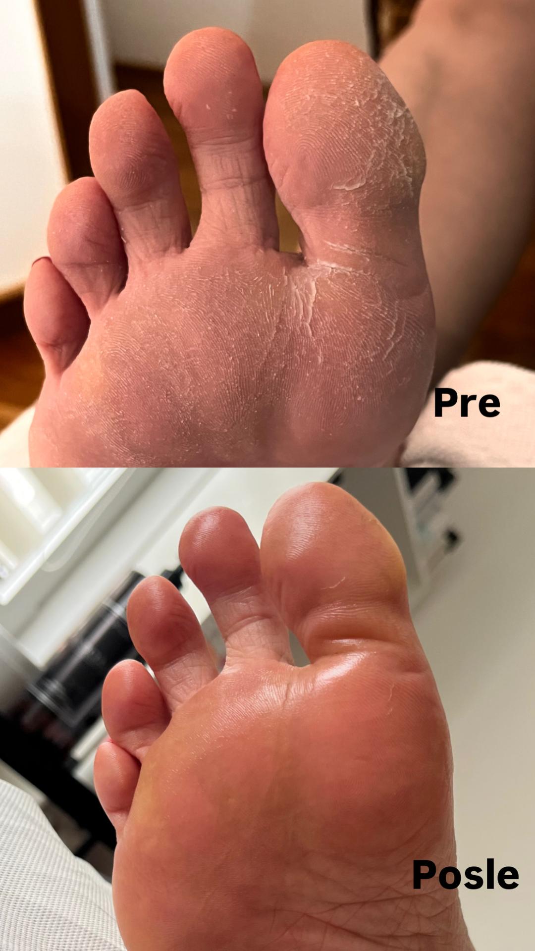 Ruski pedikir - Belle Ana, Beograd Estetski pedikir Nokti Estetski pedikir, Beograd, Vračar, Čubura, Crveni krst