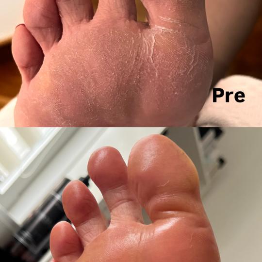 Belle Ana #beograd Estetski pedikir Ruski pedikir Ruski pedikir ✨
Ovaj precizan tretman 
Temeljn