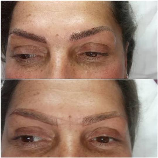 Derma Life #beograd Obrve Japansko iscrtavanje obrva