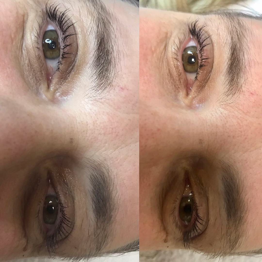 Estetic star by Maya #beograd Trepavice