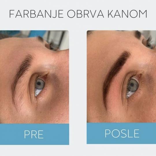 DepilConcept #beograd