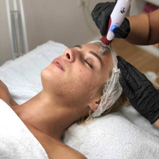 Estetic studio Ognjanović #beograd Tretman lica Dermapen tretman lica NAJTRAŽENIJI TRETMAN
Ako že