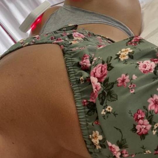 Lipolaser Centar - Matrix021 #novisad Tretmani tela 👉Neinvazivna liposukcija Diodnim laserom, zat