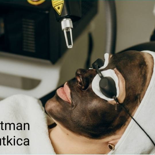 Laser centar Delight #beograd Piling lica Tretman lica karbon pilom Tretman lica crna lutkica daje 