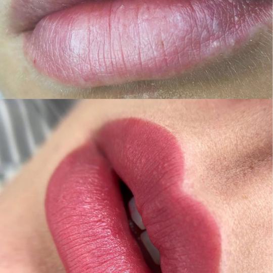 AmiSo Beauty Studio #novisad Trajna šminka Trajna šminka - usne Granule Fordajsa su lojne žlezde 