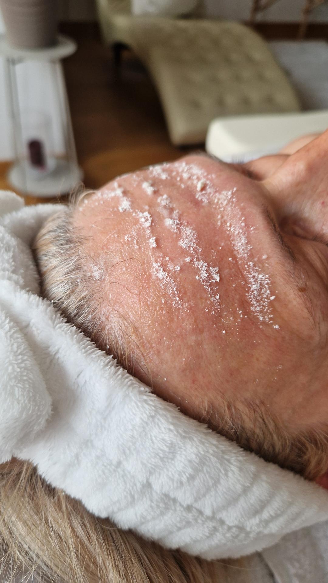 Dermapen - lice + vrat + dekolte - Glow Holistic Studio, Beograd Dermaroler i dermapen Lice Dermaroler i dermapen, Beograd, Novi Beograd blokovi, Belville, Savski kej