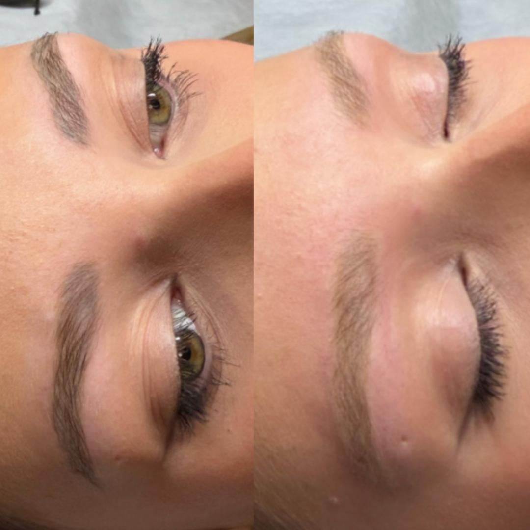 Beauty Blend #beograd Trajna šminka Lasersko skidanje trajne šminke