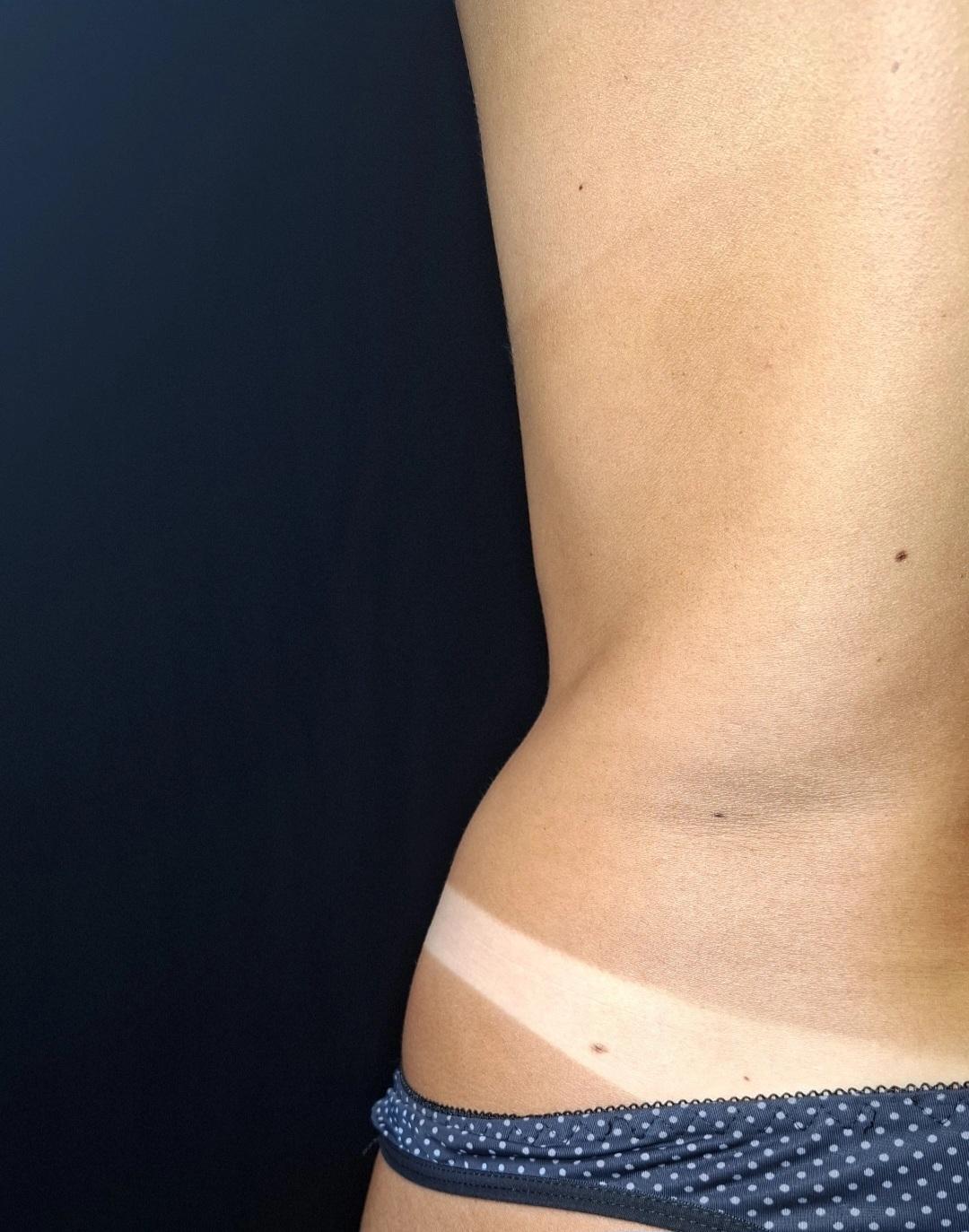 Voyage beauty #beograd Air brush potamnjivanje kože Spray tan - celo telo