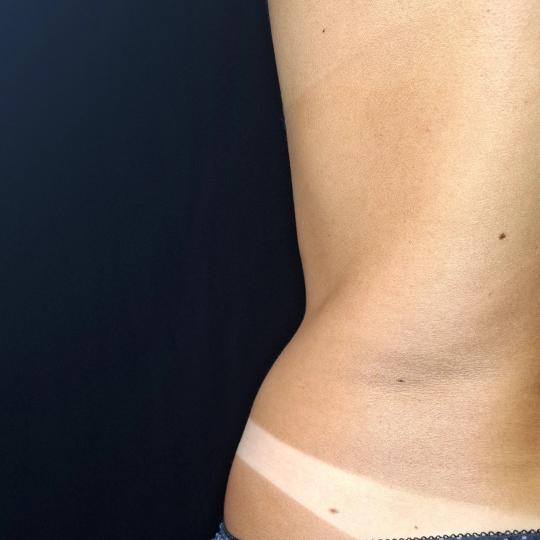 Voyage beauty #beograd Air brush potamnjivanje kože Spray tan - celo telo