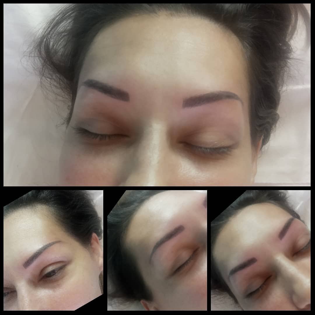 Derma Life #beograd Obrve