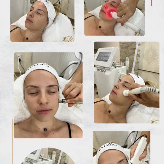 Duluz G&D Beauty #novisad Tretman lica Complex C tretman Babor kozmetikom osvezite i nahranite vasu 