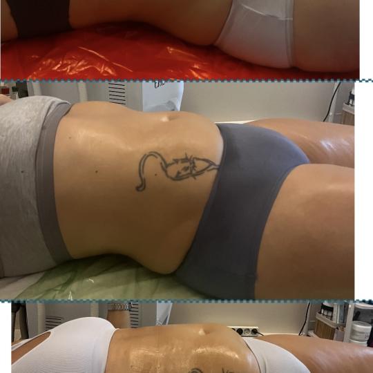 Diamond beauty M #beograd Anticelulit masaža Vacum 65 body + limfna drenaža Masaža
