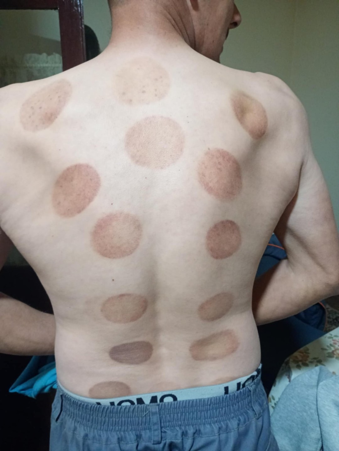 Relax body centar #zajecar Masaža teglama Mokra hidžama