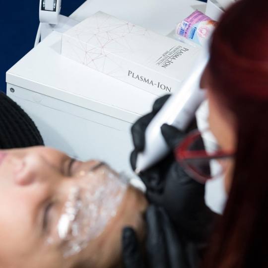 Ashanti Beauty Salon & Academy #beograd Tretman lica Plasma pen - horizontalne bore čela
