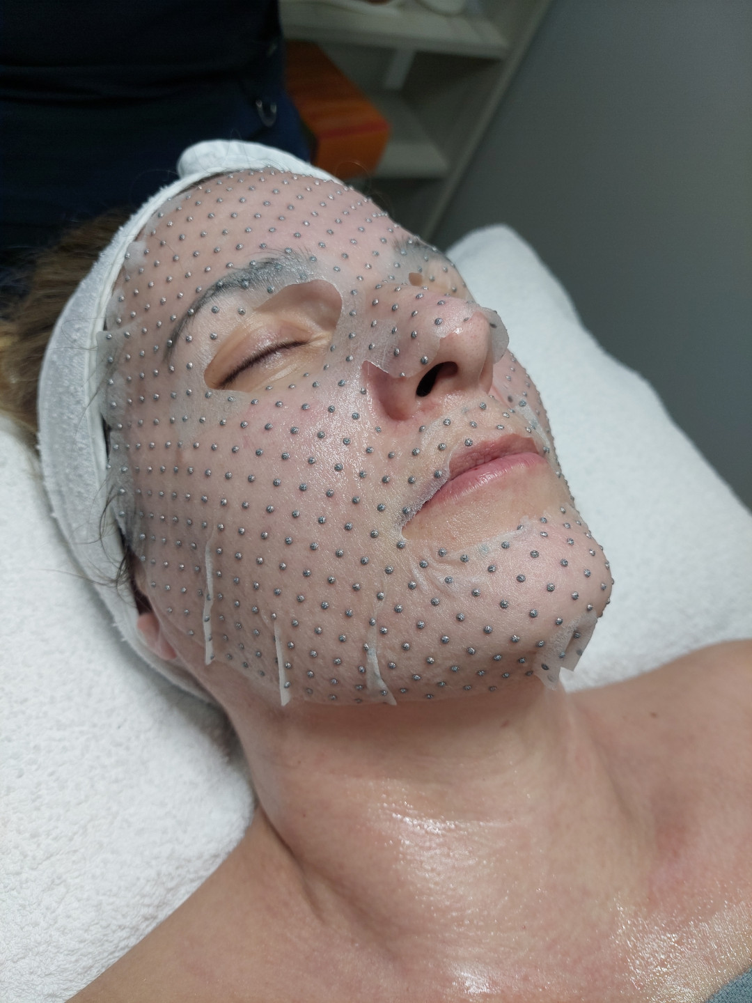 Beauty Palace by M #beograd Tretman lica Hidrafacial