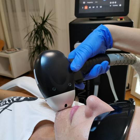 Glow beauty studio #beograd Laserska epilacija Laserska epilacija brade - za dame