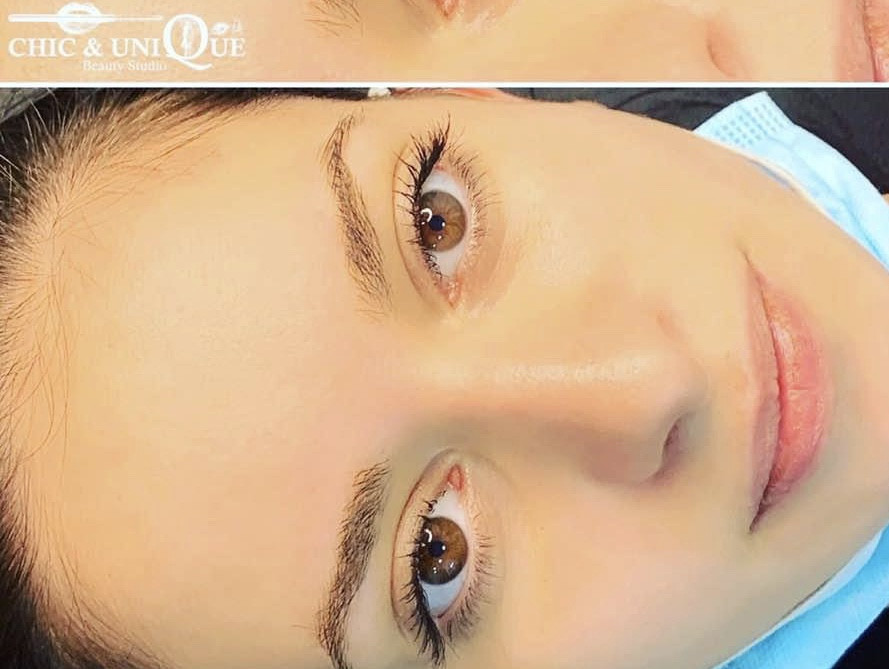 Chic & Unique Beauty Studio #beograd Laserska epilacija