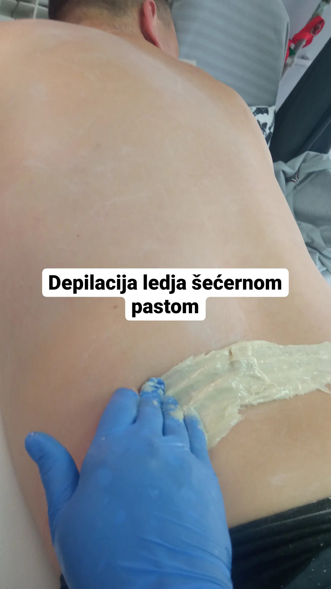 Gaga G&T #beograd Depilacija šećernom pastom Depilacija leđa šećernom pastom - za muškarce