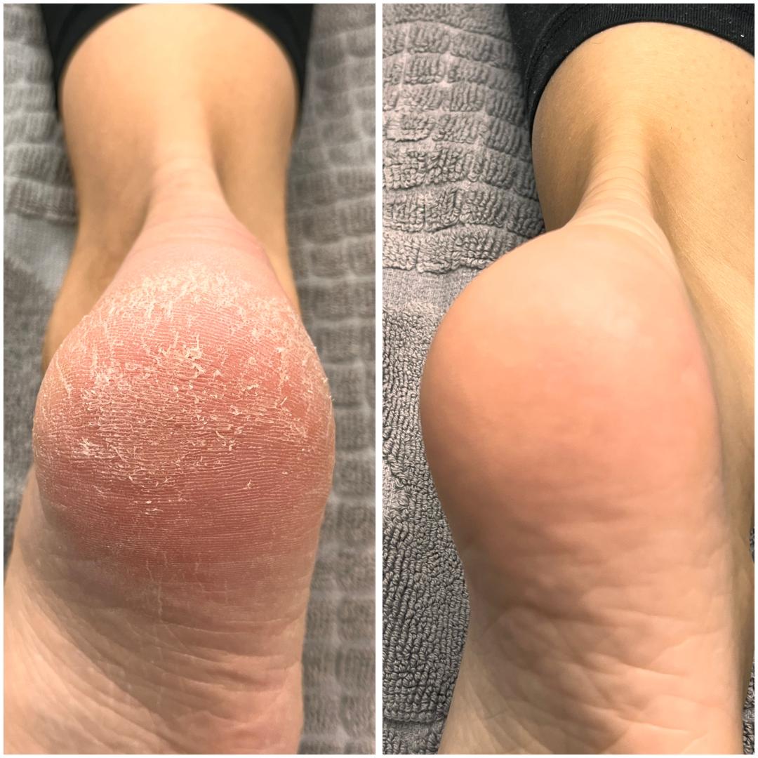 Belle Ana #beograd Estetski pedikir Ruski pedikir