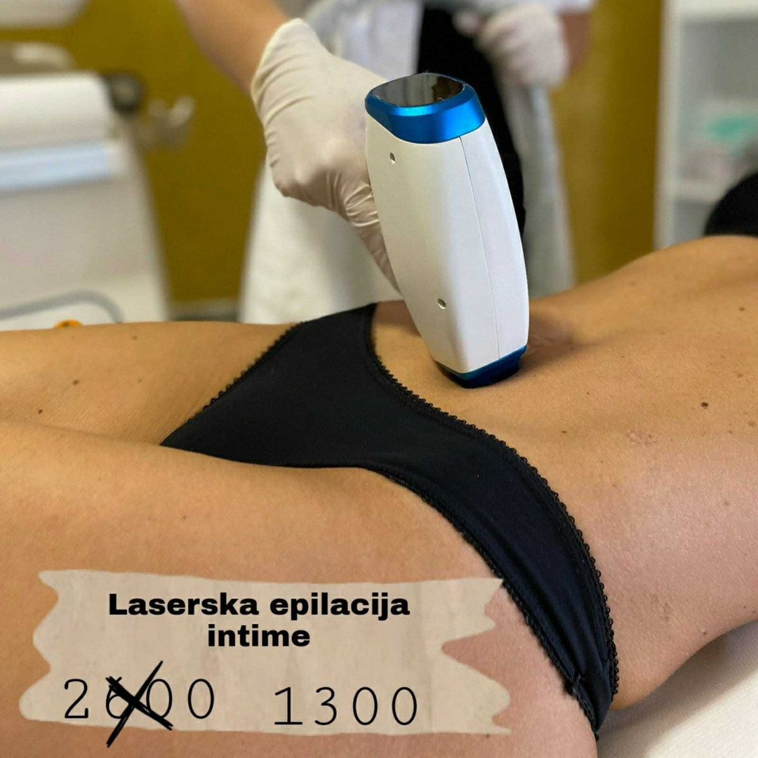 D&D Beauty Center #beograd Laserska epilacija Brazilska laserska epilacija - za dame