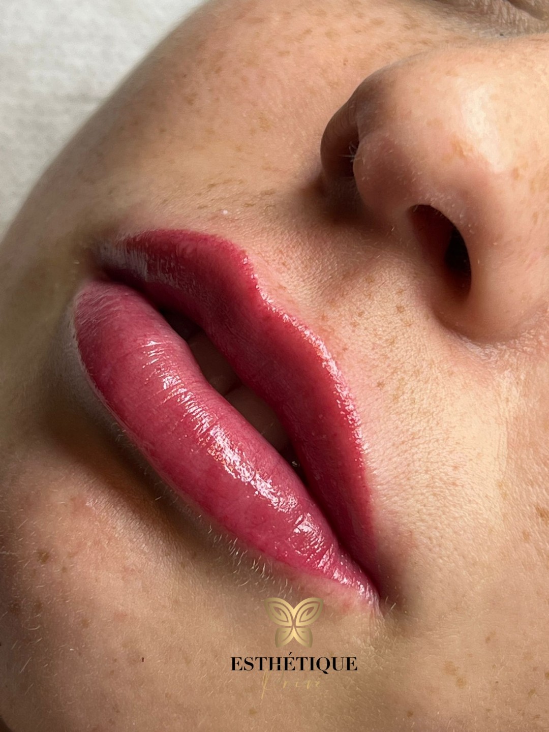 Esthetique Privé #beograd Trajna šminka Trajna šminka usana - PHILIPPS