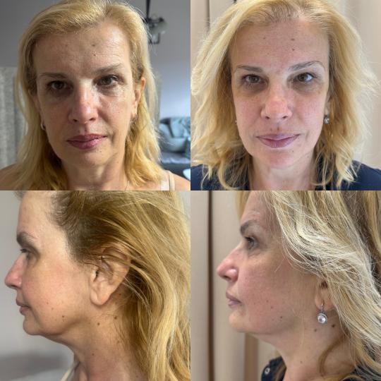 Amelie touch beauty usluga