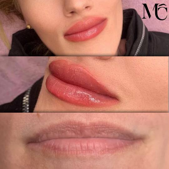 Aurora Beauty Studio #beograd Trajna šminka Trajna šminka usana