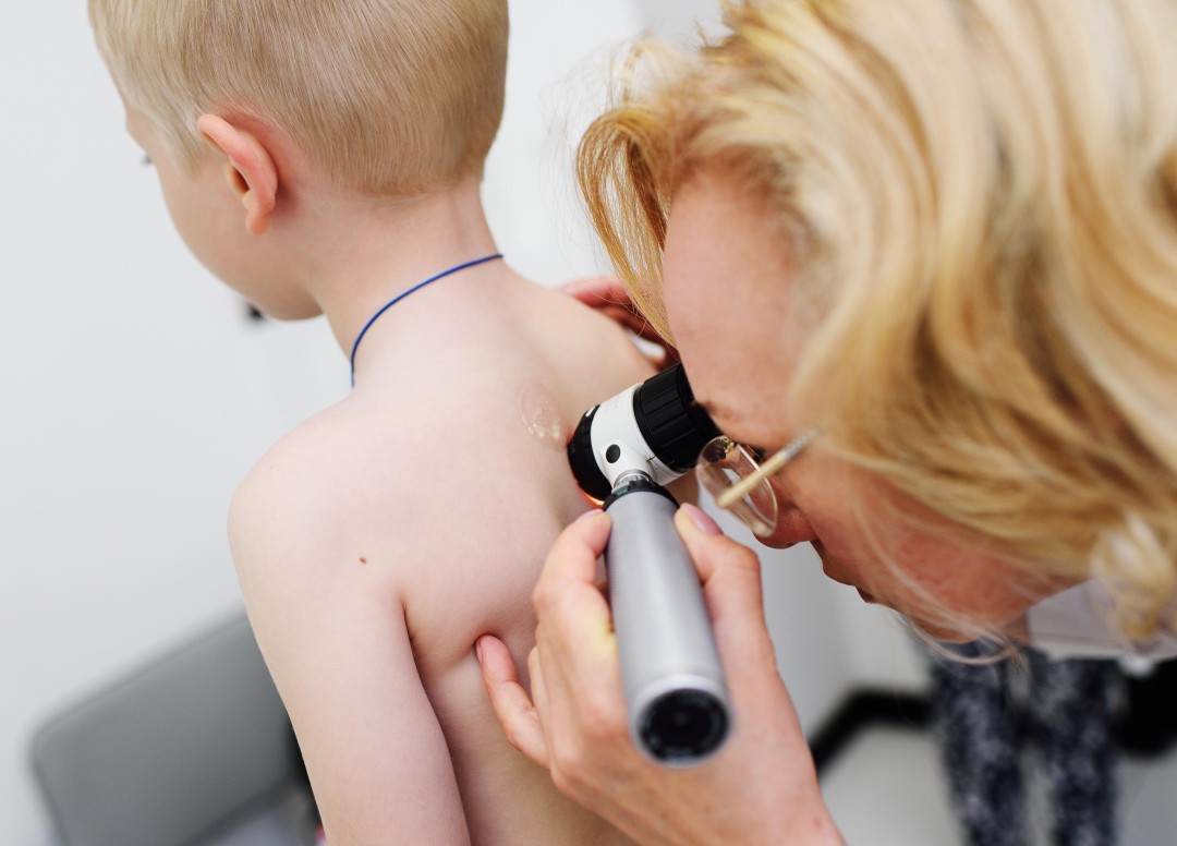 Diva Medical #beograd Medicinski pregledi i konsultacije Dermatološki pregled dece