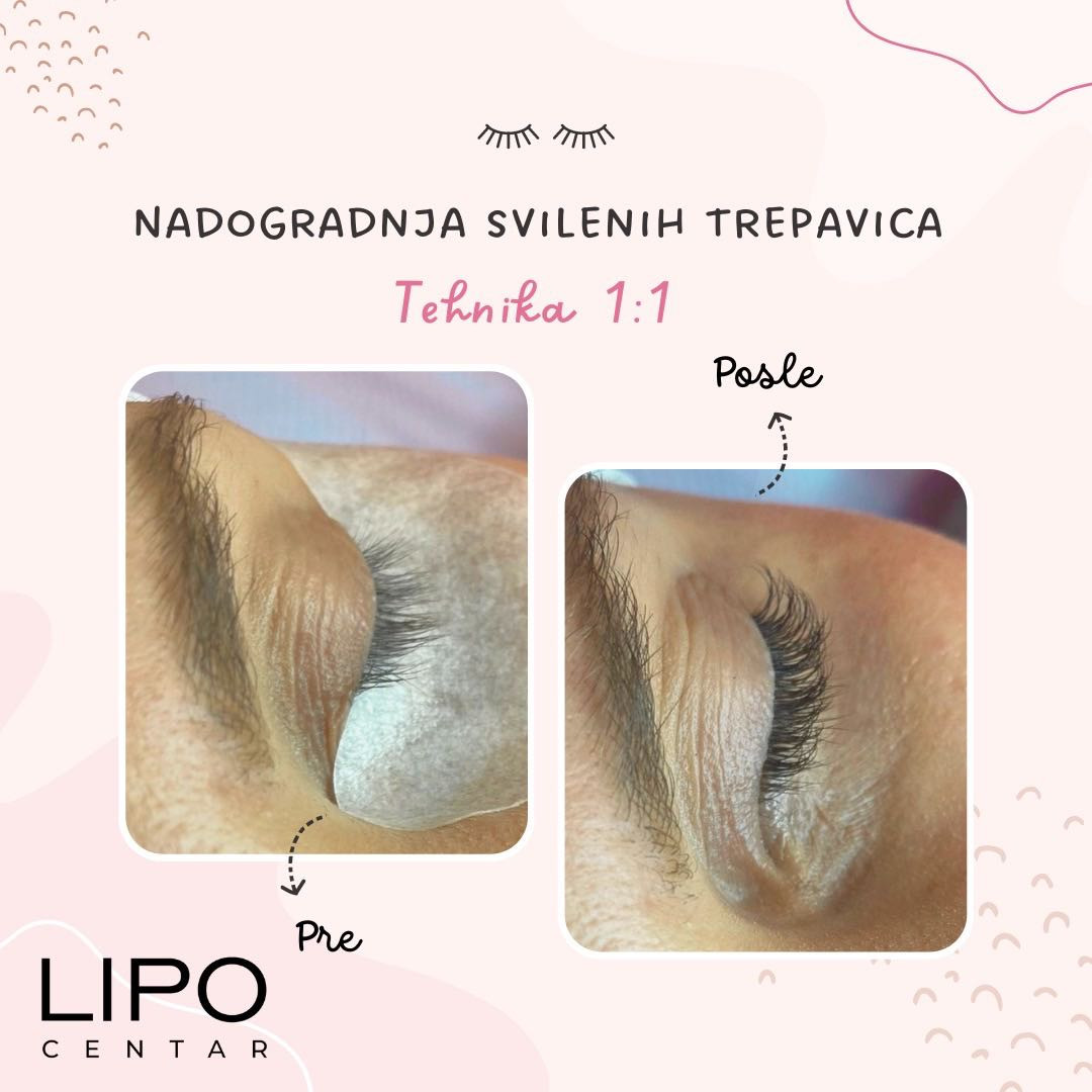 Nadogradnja svilenih trepavica 1 na 1 - Lipo Centar, Beograd Nadogradnja trepavica Lice Nadogradnja trepavica, Beograd, Zvezdara