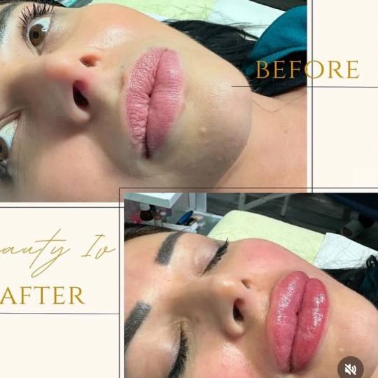 Beauty Hoakina #beograd Trajna sminka usana ✨Labelo lips-trajna šminka usana✨
✅Otok spada kr