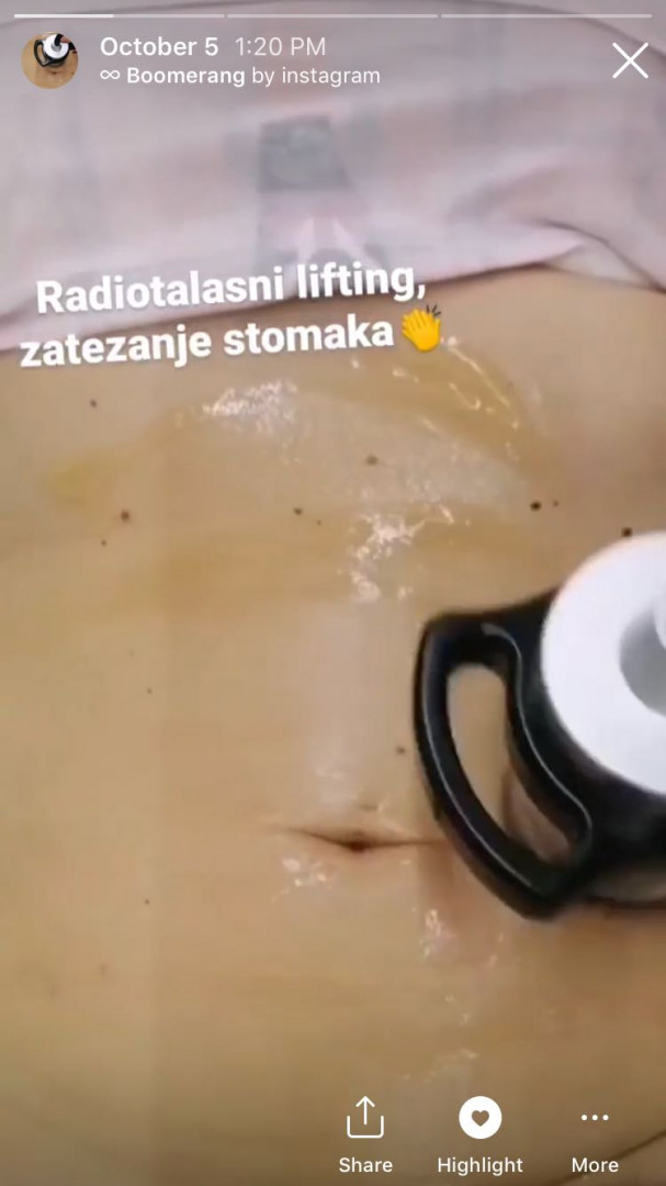 Body Beauty Balance 2020 #beograd Radiotalasni i ultrazvučni tretmani