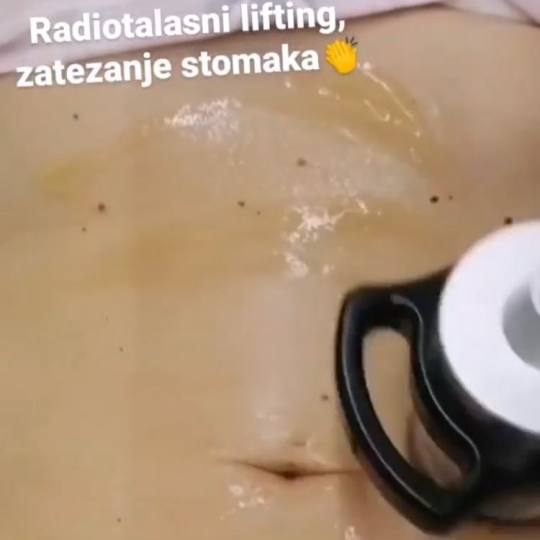 Body Beauty Balance 2020 #beograd Radiotalasni i ultrazvučni tretmani
