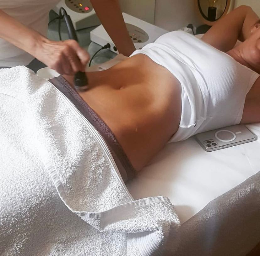 Bellagio beauty center #beograd Tretman lica Ultrazvučni lifting - stomak + bokovi + ruke + gluteus