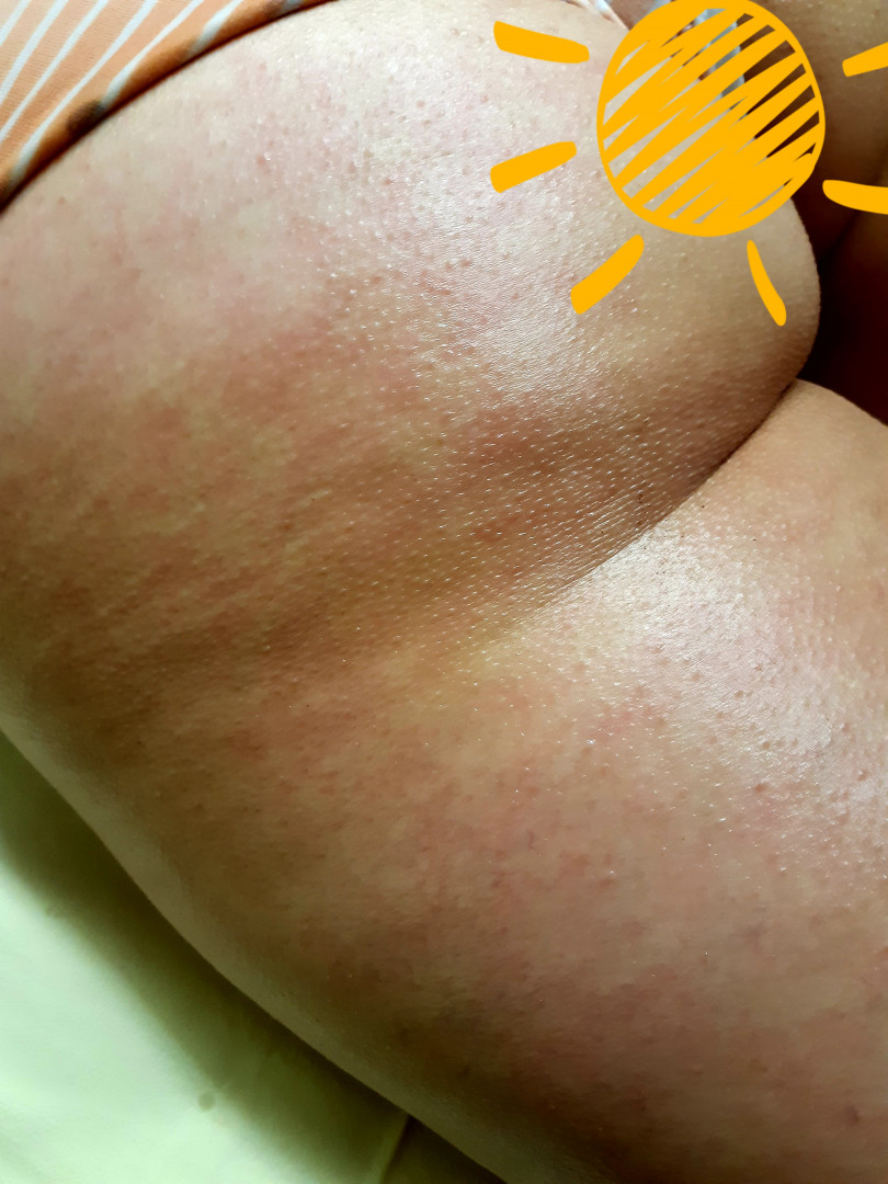 Maderoterapija - noge + stomak 45 min. - Migun centar relax, Beograd Anticelulit masaža Masaža Anticelulit masaža, Beograd, Centar, Stari grad, Dorćol