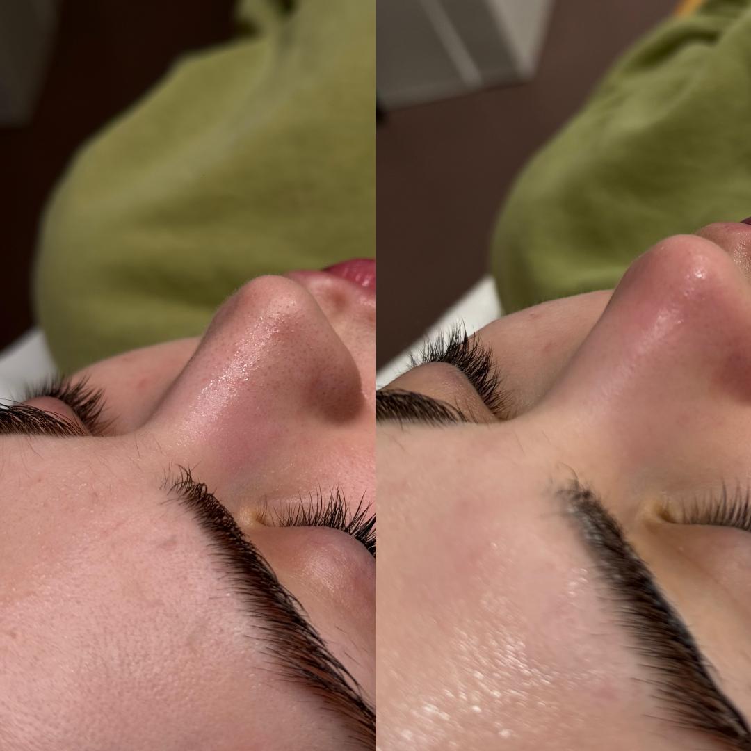 L’Avenue #beograd Tretman lica Higijenski tretman lica