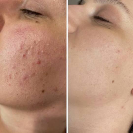 Mila Beauty Centar usluga