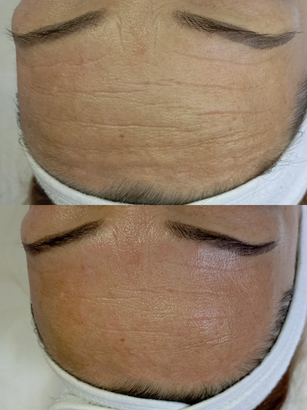 Factor Estetic #beograd Tretman lica Personalizovani tretman lica