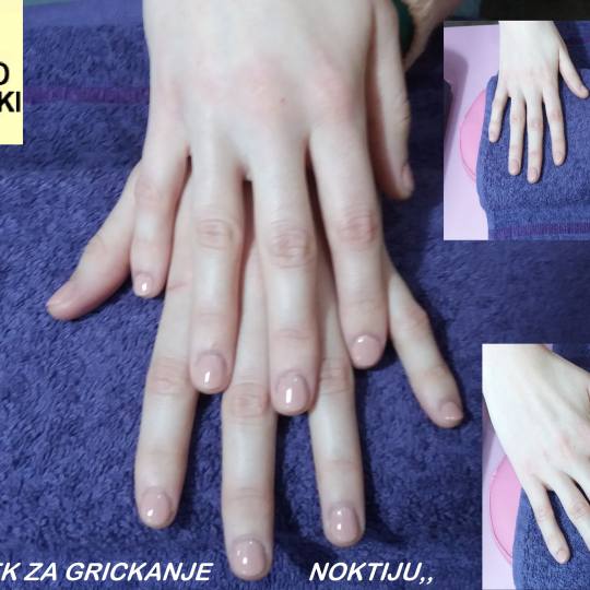Lix masažno kozmetički centar - Vojvode Stepe #beograd ,,GEL LAK LEK ZA GRICKANJE NOKTIJU,, ukolik