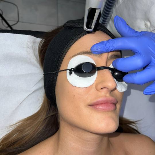 Laser centar Delight #beograd Trajna šminka Uklanjanje trajne šminke laserom obrva ili usana Razlo