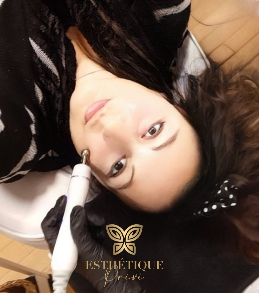 Esthetique Privé #beograd Tretman lica Hydrafacial tretman lica + čišćenje lica