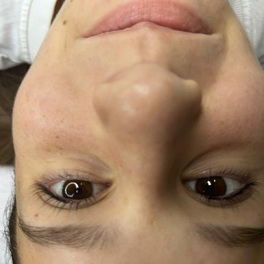 MiViDa Beauty System usluga