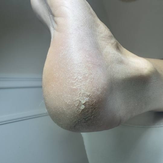MS Beauty Centar #beograd Estetski pedikir Klasični pedikir