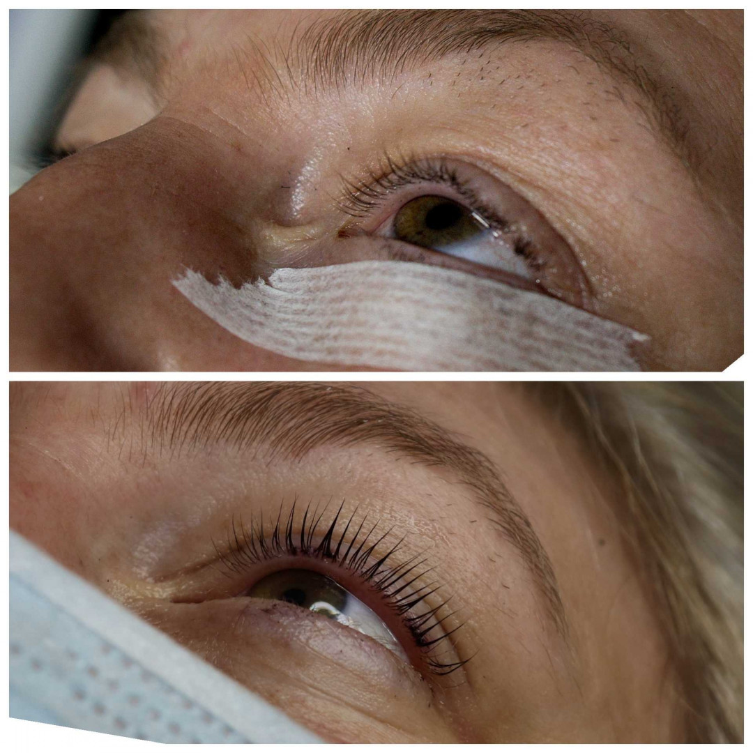 Lash lift + farbanje trepavica + botox - M Studio 0303, Novi Sad Trepavice Lice Trepavice, Novi Sad, Sajmište, Detelinara, Banatić