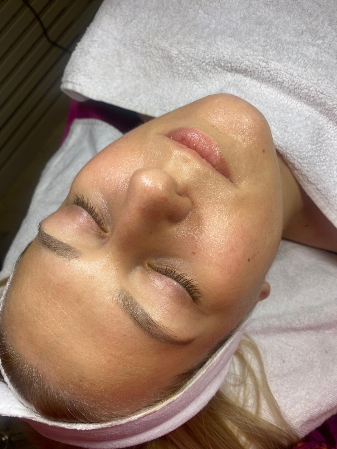 Angels #novisad Tretman lica Bioloski tretman lica sa lux maskom Vampire infusion