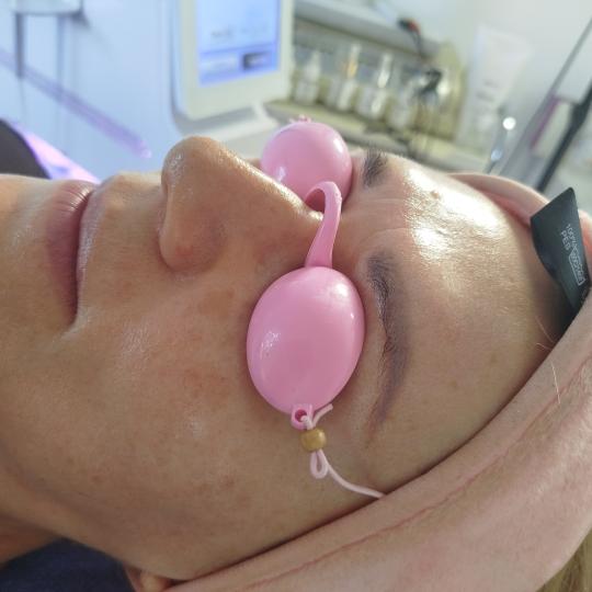 Professional beauty and spa #beograd Tretmani tela Akcija ultrazvucno ciscenje lifting i mezo Nakon 