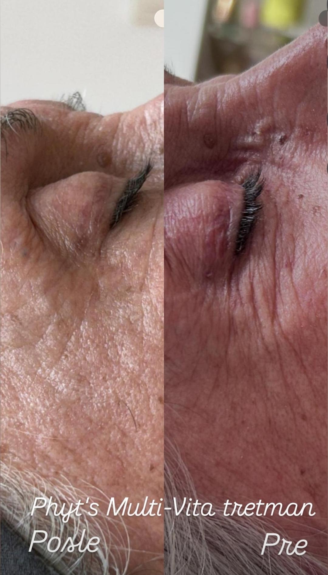 Phyt's tretman - aromalliance anti-age multi-vita - Glow Holistic Studio, Beograd Masaža lica Lice Masaža lica, Beograd, Novi Beograd blokovi, Belville, Savski kej