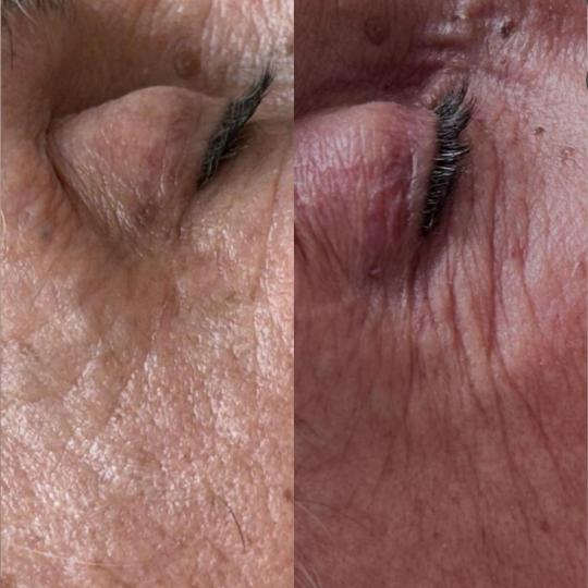 Glow Holistic Studio #beograd Masaža lica Phyt's tretman - aromalliance anti-age multi-vita Ph