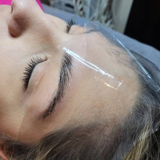 Starmedic #beograd Trepavice Brow lift